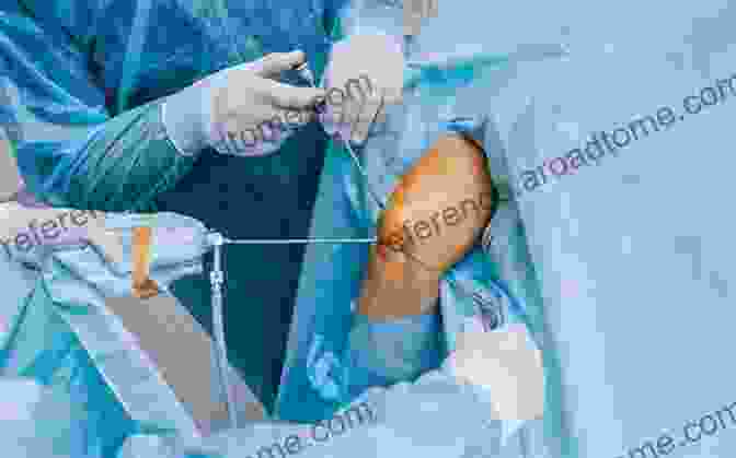 Arthroscopic Knee Surgery Technique Knee Surgery: Tricks Of The Trade