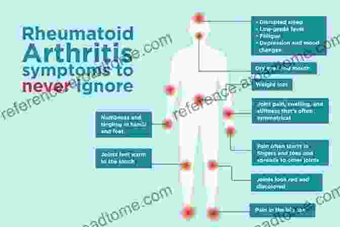 Common Symptoms Of Rheumatic Diseases Skills In Rheumatology