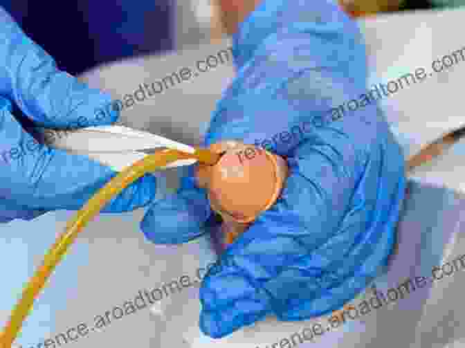 Image Of A Catheter Being Inserted Into A Patient's Blood Vessel Learning Interventional Radiology