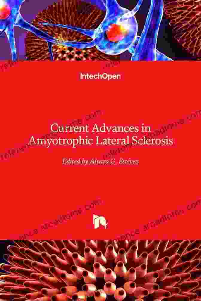 Image Showcasing Ongoing Research And Advancements In Amyotrophic Lateral Sclerosis (ALS) Amyotrophic Lateral Sclerosis Richard A Driscoll O D