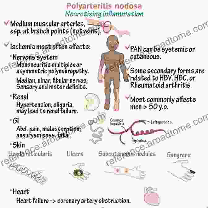 Large And Medium Size Vessel And Single Organ Vasculitis: Rare Diseases Of The Large And Medium Size Vessel And Single Organ Vasculitis (Rare Diseases Of The Immune System)