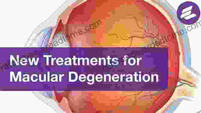 Macular Degeneration: Macular Regeneration Natural Vision Eye Care Macular Degeneration Macular Regeneration (Natural Vision Eye Care 3)