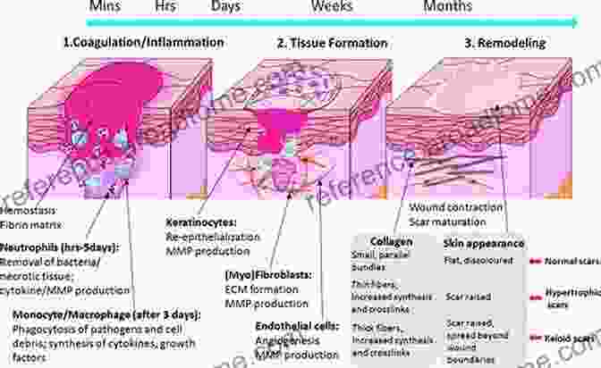 Microscopic Image Of A Wound Healing Process Tissue Repair And Fibrosis: The Role Of The Myofibroblast (Current Topics In Pathology 93)