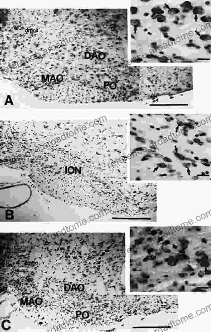 Photomicrograph Showing Neurons In The Inferior Olivary Complex The Inferior Oilvary Complex (Advances In Anatomy Embryology And Cell Biology 155)