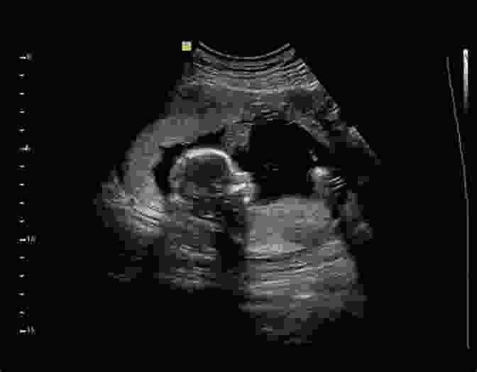 Ultrasound Imaging Of A Fetus Imaging For The Health Care Practitioner