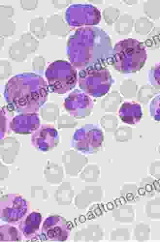 Chronic Myeloid Leukemia