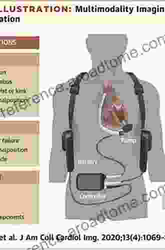 Mechanical Support For Heart Failure: Current Solutions And New Technologies