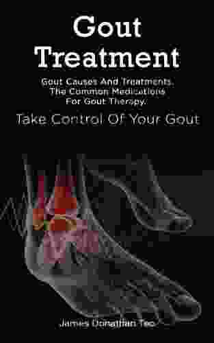 Gout Treatment: Gout Causes And Treatments The Common Medications For Gout Therapy Take Control Of Your Gout