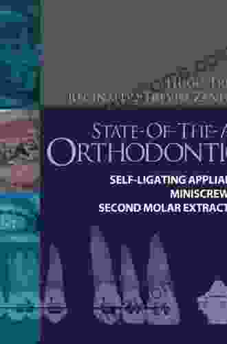 State Of The Art Orthodontics E Book: Self Ligating Appliances Miniscrews And Second Molars Extraction