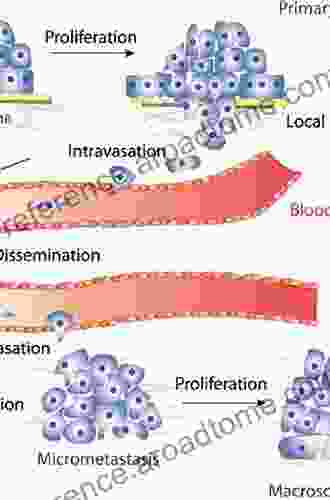 The Thorax (Cancer Dissemination Pathways)