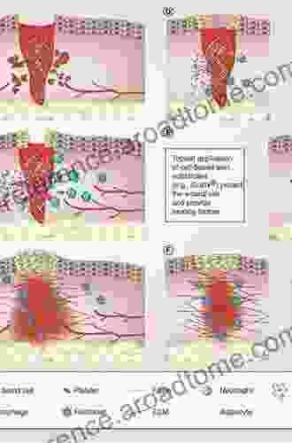 Tissue Repair And Fibrosis: The Role Of The Myofibroblast (Current Topics In Pathology 93)