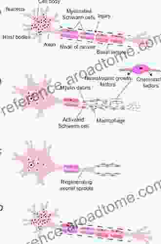 Degeneration and Regeneration in the Nervous System