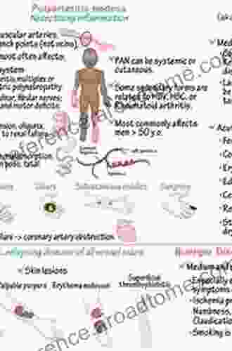 Large And Medium Size Vessel And Single Organ Vasculitis (Rare Diseases Of The Immune System)